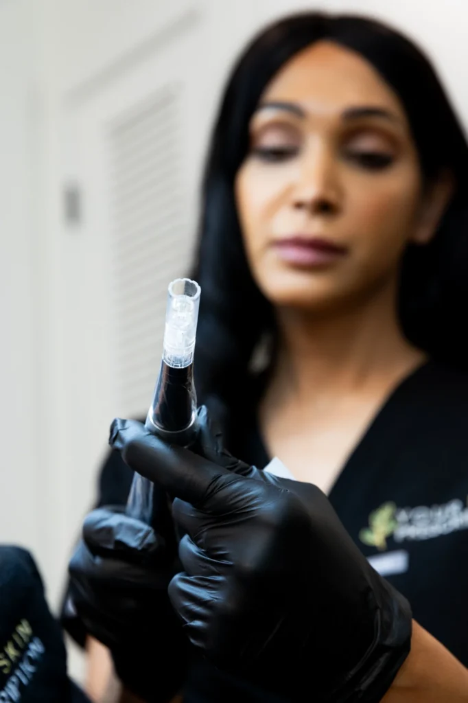 microneedling in sewickley