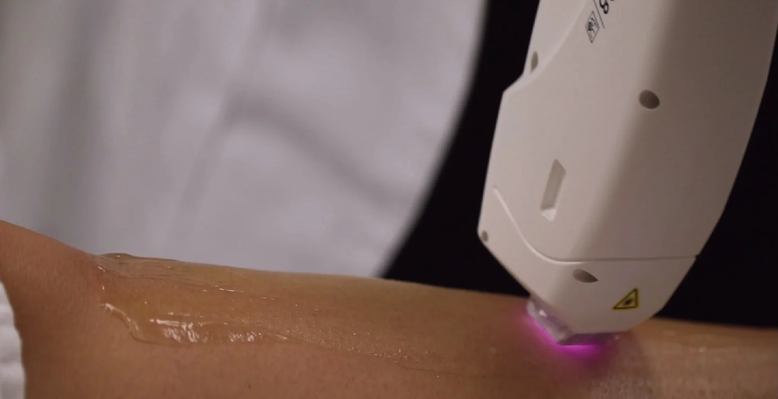 laser hair removal sewickley