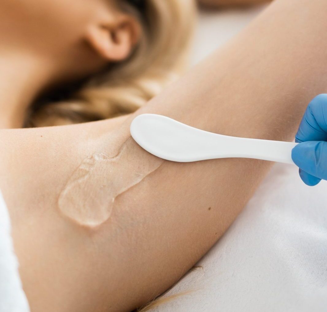 laser hair removal in Sewickley